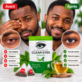 Clear Eyes – Tisane aux Plantes pour le Bien-être Oculaire